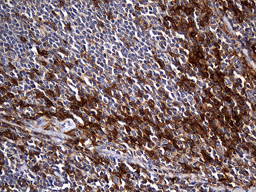 m01650 anti carboxypeptidase m cpm mouse monoclonal antibody clone id oti4e11 ihc testing 7