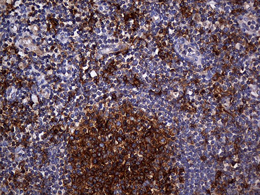 m01650 anti carboxypeptidase m cpm mouse monoclonal antibody clone id oti4e11 ihc testing 8