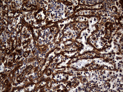m01650 anti carboxypeptidase m cpm mouse monoclonal antibody clone id oti4e11 ihc testing 9