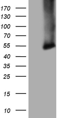HEK293T cells were transfected with the pCMV6-ENTRY control (Left lane) or pCMV6-ENTRY CPM (Right lane) cDNA for 48 hrs and lysed