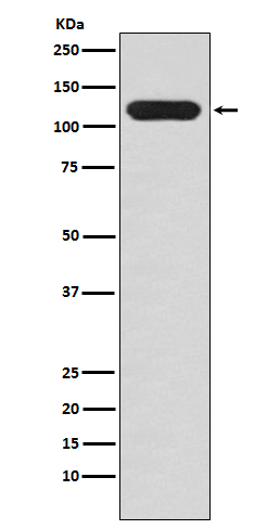 Western blot analysis of MUC4 expression in MCF7 cell lysate
