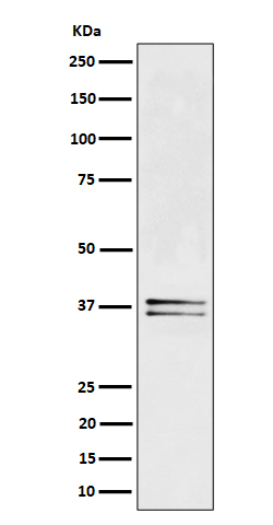 Western blot analysis of LAT expression in Jurkat cell lysate