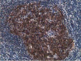 Immunohistochemical staining of paraffin-embedded Human lymph node tissue within the normal limits using anti-DCK mouse monoclonal antibody
