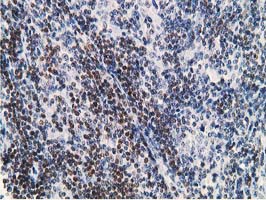 m01655 1 anti dck mouse monoclonal antibody clone id oti3f5 ihc testing 4