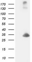 HEK293T cells were transfected with the pCMV6-ENTRY control (Left lane) or pCMV6-ENTRY DCK (Right lane) cDNA for 48 hrs and lysed