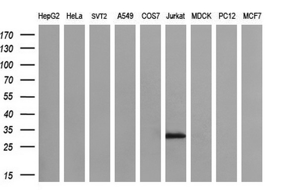 Western blot analysis of extracts (35ug) from 9 different cell lines by using anti-DCK monoclonal antibody (HepG2: human; HeLa: human; SVT2: mouse; A549: human; COS7: monkey; Jurkat: human; MDCK: canine; PC12: rat; MCF7: human) (1:200)