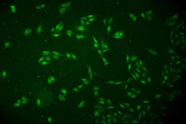 m01655 dck primary antibodies if testing 3