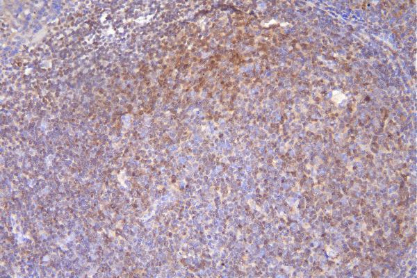 m01655 dck primary antibodies ihc testing 2