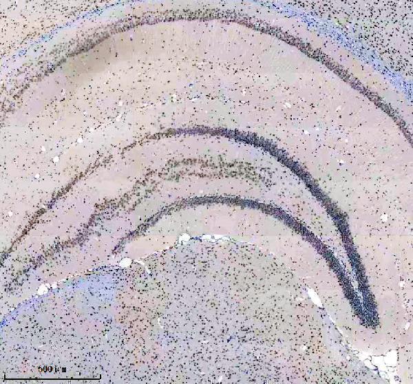 IHC analysis of DDX17 using anti-DDX17 antibody (M01656)