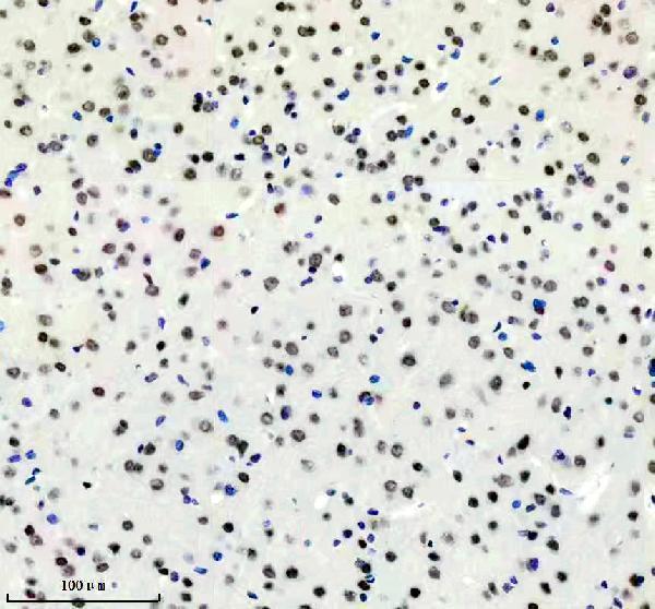 IHC analysis of DDX17 using anti-DDX17 antibody (M01656)