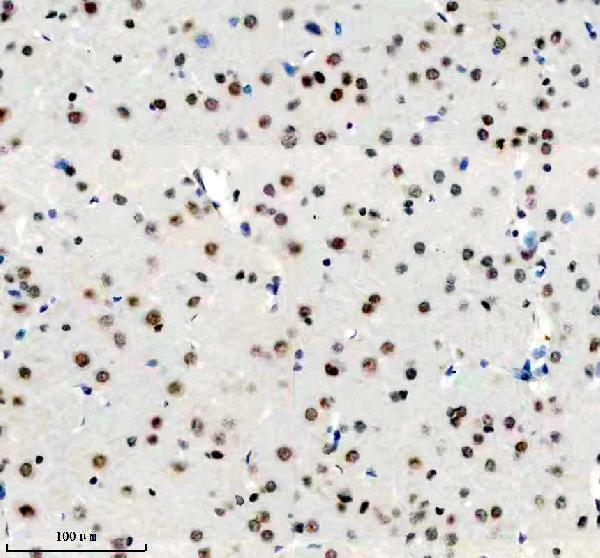 m01656 ddx17 primary antibodies ihc testing 3
