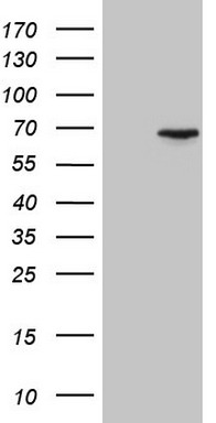 HEK293T cells were transfected with the pCMV6-ENTRY control (Left lane) or pCMV6-ENTRY CEP63 (Right lane) cDNA for 48 hrs and lysed