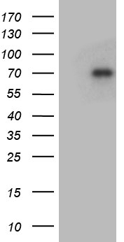 HEK293T cells were transfected with the pCMV6-ENTRY control (Left lane) or pCMV6-ENTRY GRB10 (Right lane) cDNA for 48 hrs and lysed