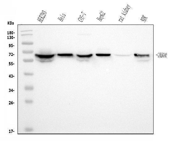  Western blot analysis of GRB10 using anti-GRB10 antibody (M01663)