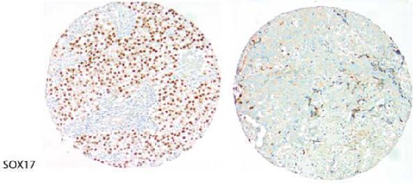 m01665 1 anti sox17 mouse monoclonal antibody clone id oti2g8 ihc testing 3
