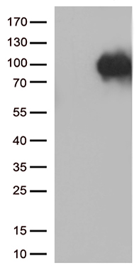 HEK293T cells were transfected with the pCMV6-ENTRY control (Left lane) or pCMV6-ENTRY SORT1 (Right lane) cDNA for 48 hrs and lysed