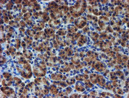 Immunohistochemical staining of paraffin-embedded Human pancreas tissue within the normal limits using anti-UNG mouse monoclonal antibody