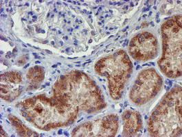 m01672 1 anti ung mouse monoclonal antibody clone id oti1f8 ihc testing 4