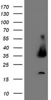 HEK293T cells were transfected with the pCMV6-ENTRY control (Left lane) or pCMV6-ENTRY UNG (Right lane) cDNA for 48 hrs and lysed