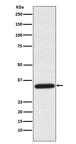 Western blot analysis of UNG expression in HeLa cell lysate