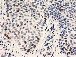 m01672 anti ung mouse monoclonal antibody clone id oti1a11 ihc testing 4