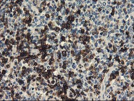 m01672 anti ung mouse monoclonal antibody clone id oti1a11 ihc testing 5