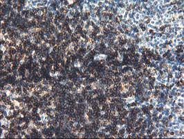 m01672 anti ung mouse monoclonal antibody clone id oti1a11 ihc testing 6