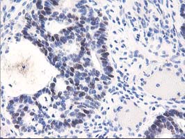 m01672 anti ung mouse monoclonal antibody clone id oti1a11 ihc testing 7