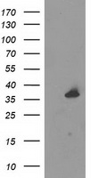 HEK293T cells were transfected with the pCMV6-ENTRY control (Left lane) or pCMV6-ENTRY UNG (Right lane) cDNA for 48 hrs and lysed