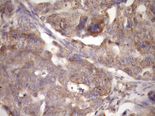 m01680 1 anti trbp tarbp2 mouse monoclonal antibody clone id oti7c1 ihc testing 5