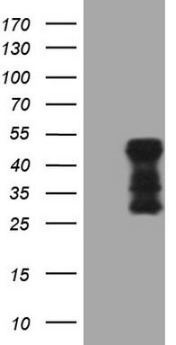 HEK293T cells were transfected with the pCMV6-ENTRY control (Left lane) or pCMV6-ENTRY TARBP2 (Right lane) cDNA for 48 hrs and lysed