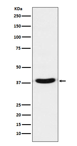Western blot analysis of TRBP expression in Jurkat cell lysate