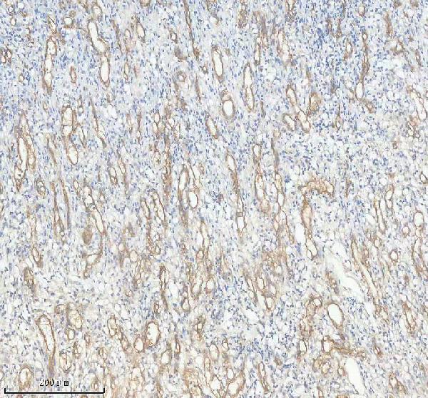 IHC analysis of CD146 using anti-CD146 antibody (M01683-1)