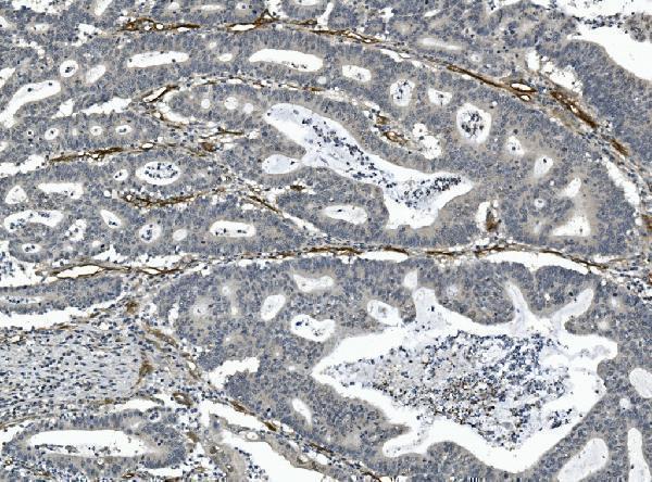  IHC analysis of CD146 using anti-CD146 antibody (M01683-4)