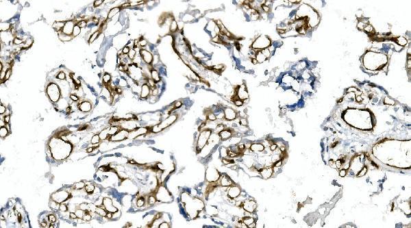  IHC analysis of CD146 using anti-CD146 antibody (M01683-4)