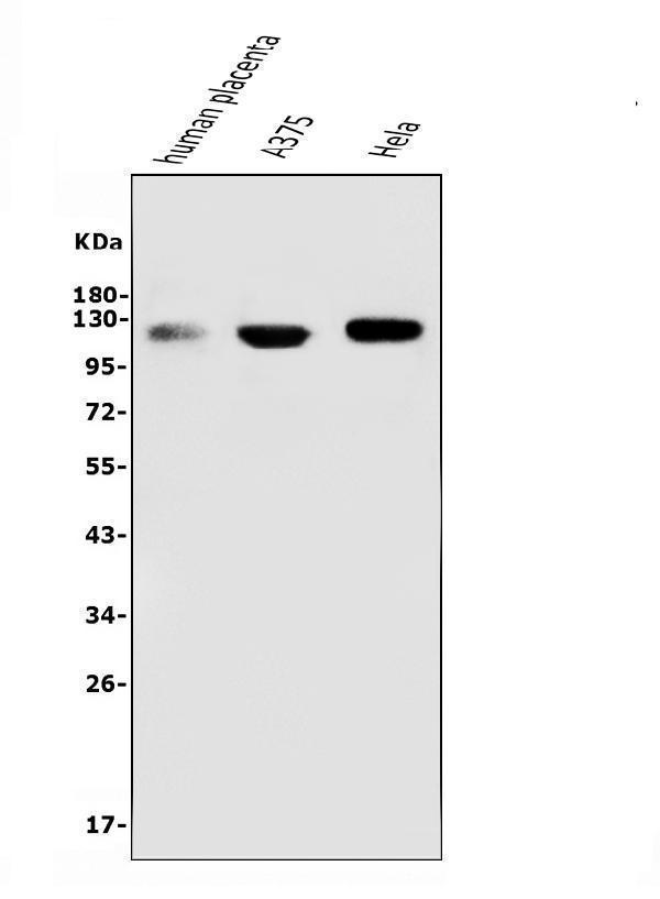  Western blot analysis of CD146 using anti-CD146 antibody (M01683-4)