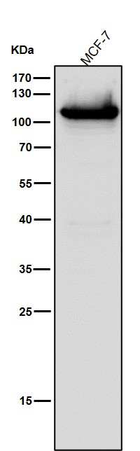 All lanes use the Antibody at 1:1k dilution for 1 hour at room temperature