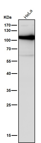 All lanes use the Antibody at 1:1k dilution for 1 hour at room temperature