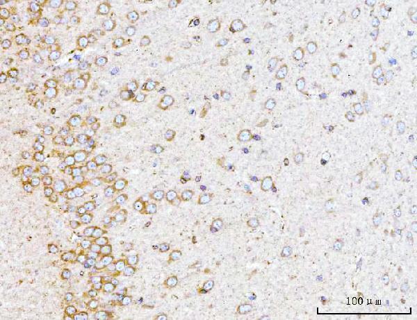m01687 2 ywhae primary antibodies ihc testing 12
