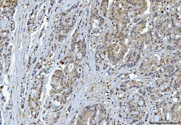 m01687 2 ywhae primary antibodies ihc testing 2