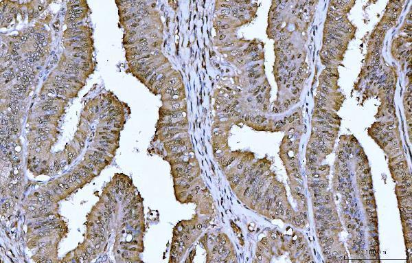 m01687 2 ywhae primary antibodies ihc testing 5