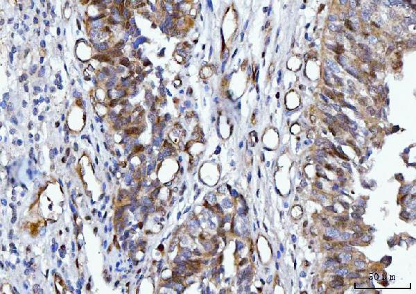 m01687 2 ywhae primary antibodies ihc testing 7