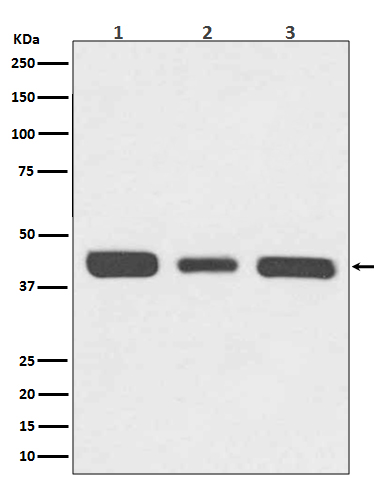 Western blot analysis of 67kDa Laminin Receptor expression in (1) HeLa cell lysate; (2) NIH/3T3 cell lysate; (3) PC-12 cell lysate