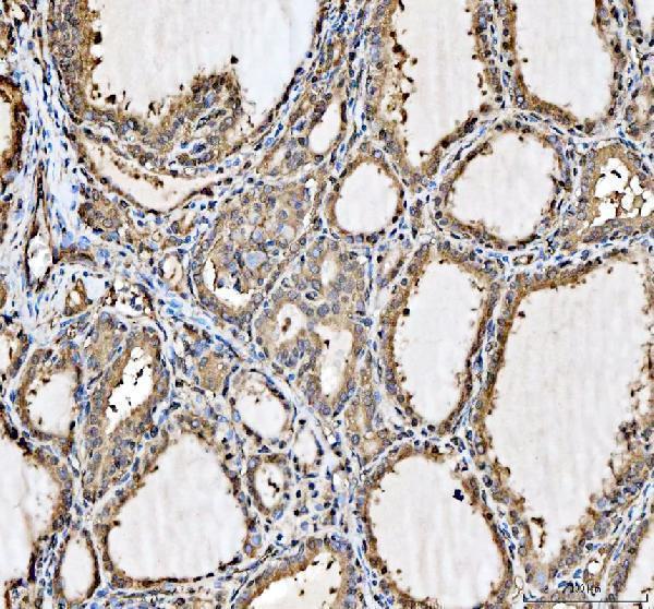 IHC analysis of Hsp90 beta/HSP90AB1 using anti-Hsp90 beta/HSP90AB1 antibody (M01692-4)