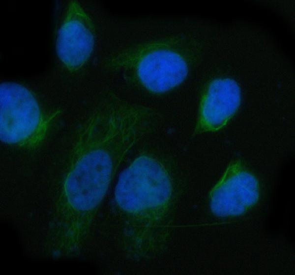 m01693 itga6 primary antibodies if testing 3