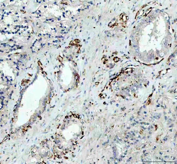 m01693 itga6 primary antibodies ihc testing 1