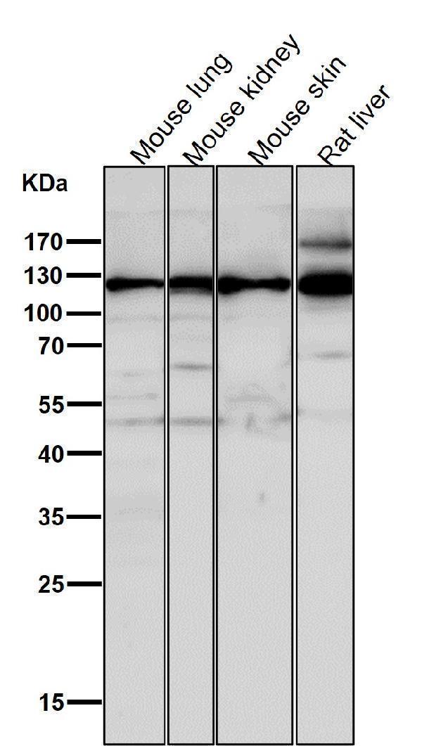 All lanes use the Antibody at 1:1W dilution for 1 hour at room temperature
