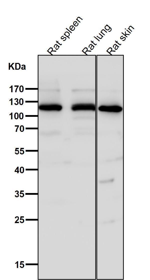 All lanes use the Antibody at 1:1W dilution for 1 hour at room temperature