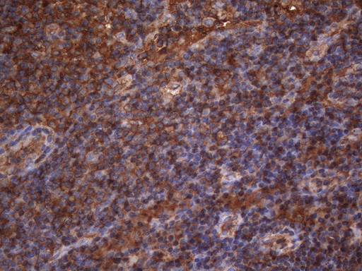 m01696 anti map3k8 mouse monoclonal antibody clone id oti2e3 ihc testing 2