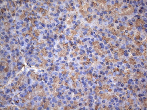 m01696 anti map3k8 mouse monoclonal antibody clone id oti2e3 ihc testing 3